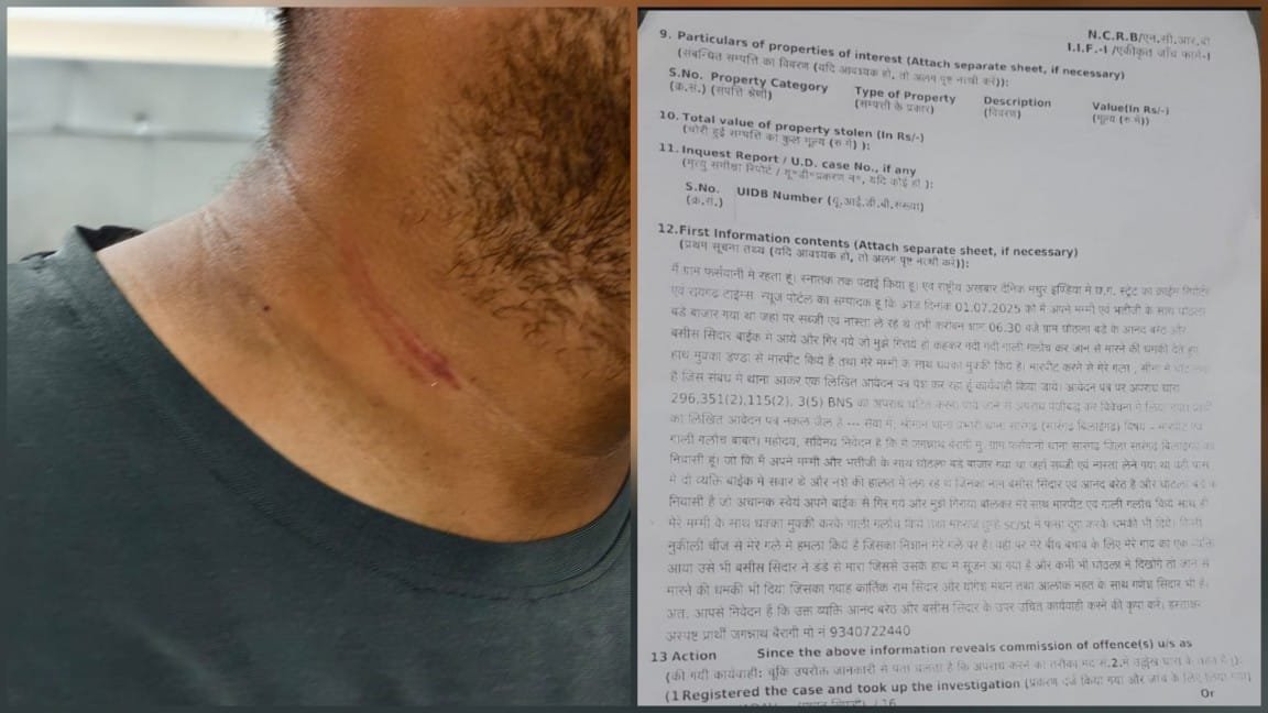 दिनदहाड़े पत्रकार पर जानलेवा हमला, गर्दन पर वार कर भागे बदमाश – कानून से बेखौफ अपराधी अब भी फरार