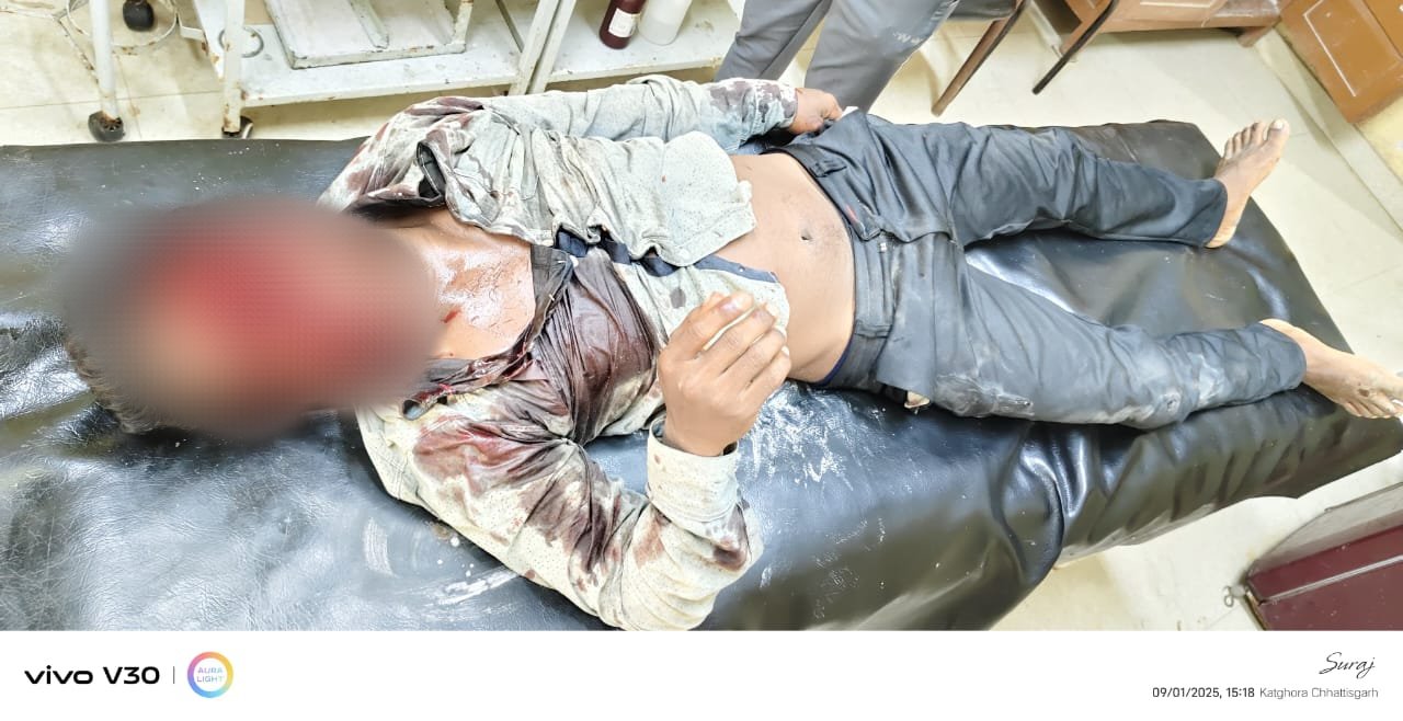 दो बाइको में आमने सामने भिडंत अज्ञात युवक और दिलीप नागवंशी/लोधु नागवंशी उम्र 30 वर्ष को लगी गंभीर चोंट