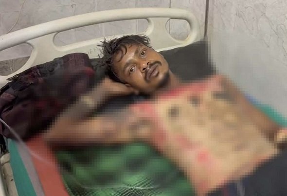 प्रेमिका के बुलावे पर पहुंचे युवक को जिंदा जलाने की कोशिश,